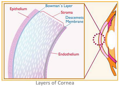 http://www.hybridcornea.org/img/aboutcornea_clip_image004.jpg